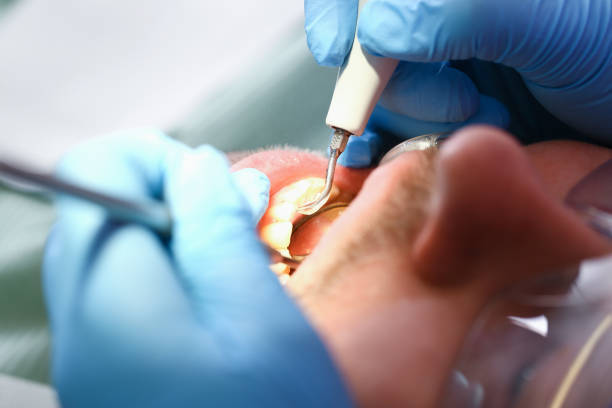 Best Emergency Denture Repair in Jonesborough, TN