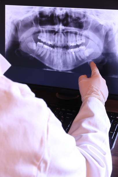 Best Emergency Treatment for Dental Infections or Abscesses in Jonesborough, TN